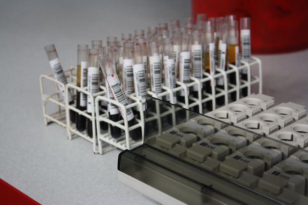 probowki_laboratorium_krew_jw